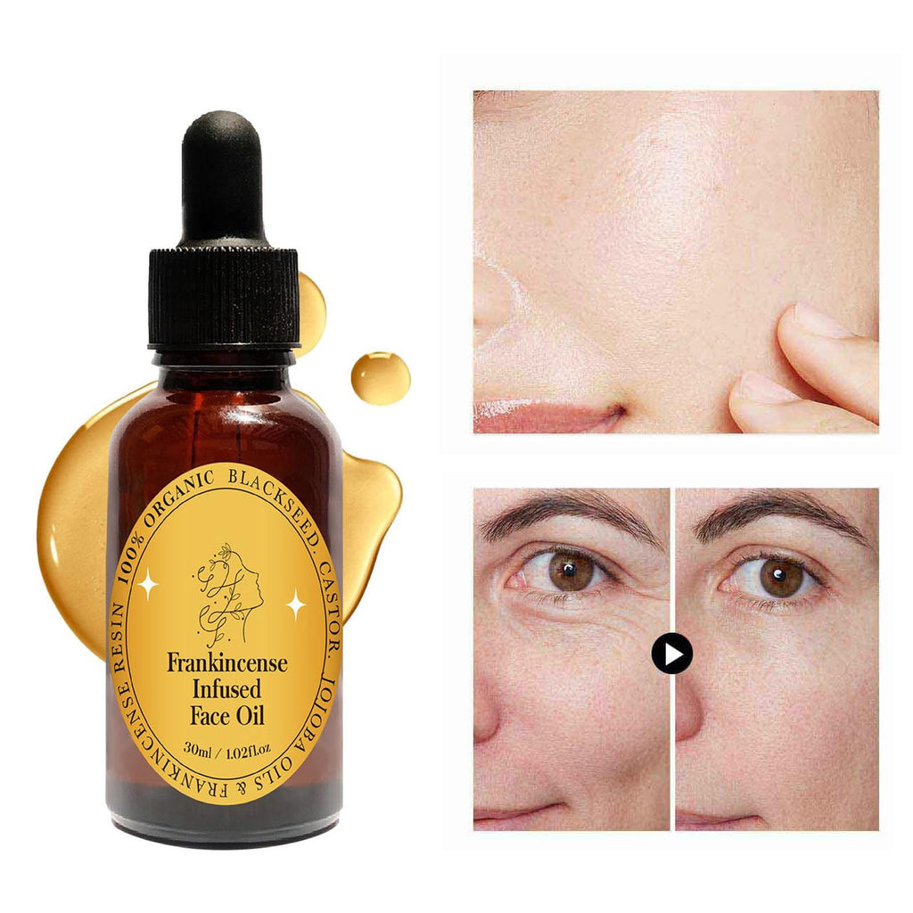 Frankincense Resin Oil Facial Serum 3PC J3306
