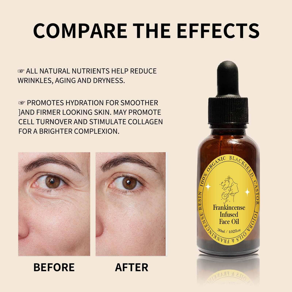 Frankincense Resin Oil Facial Serum 3PC J3306
